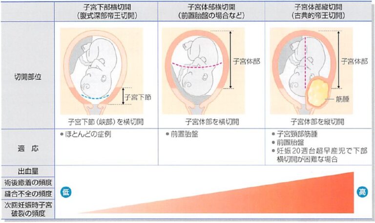 中絶は子宮にダメージを与える可能性がありますか?